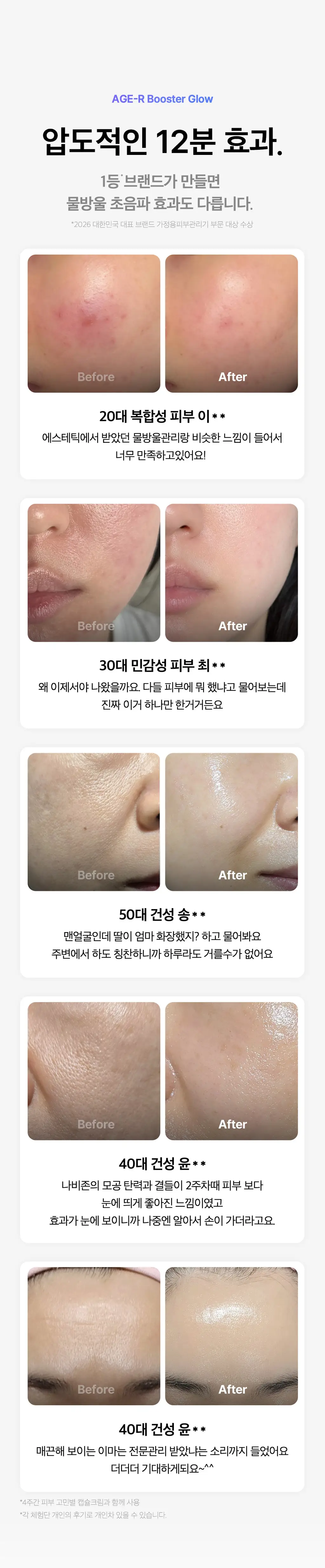 [7월 올영픽] [물방울초음파] 메디큐브 에이지알 부스터 글로우 (로즈핑크/그레이) 상세페이지 9